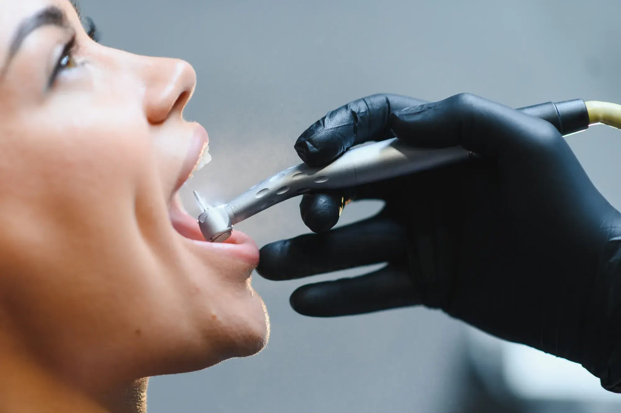 Dental hygienist using a mirror and scaler during a professional teeth cleaning and exam in Tribeca