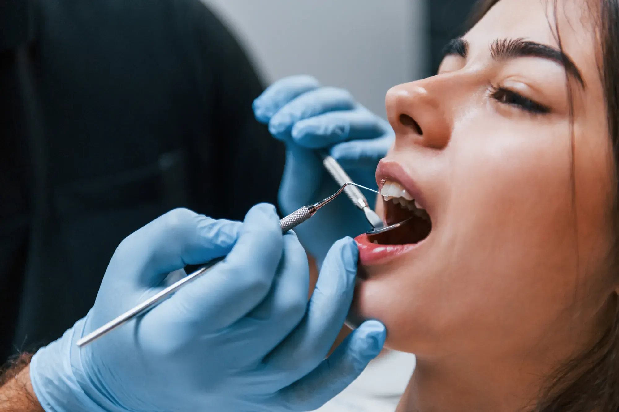 Dentist examining a patient’s receding gums before a gum grafting procedure in NYC