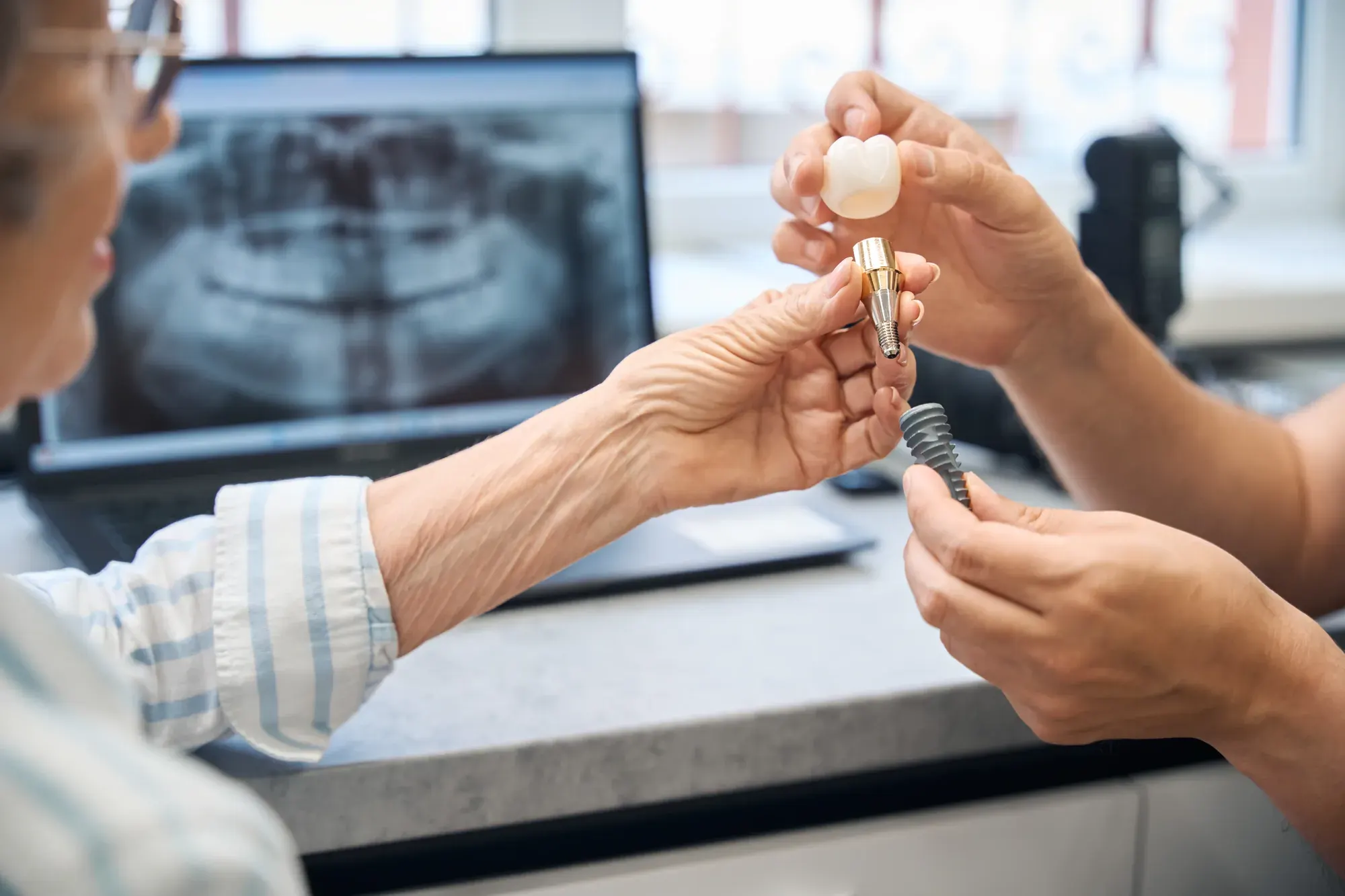 Dentist showing a senior patient a dental implant model with her X-ray on screen during an implant consultation in Tribeca
