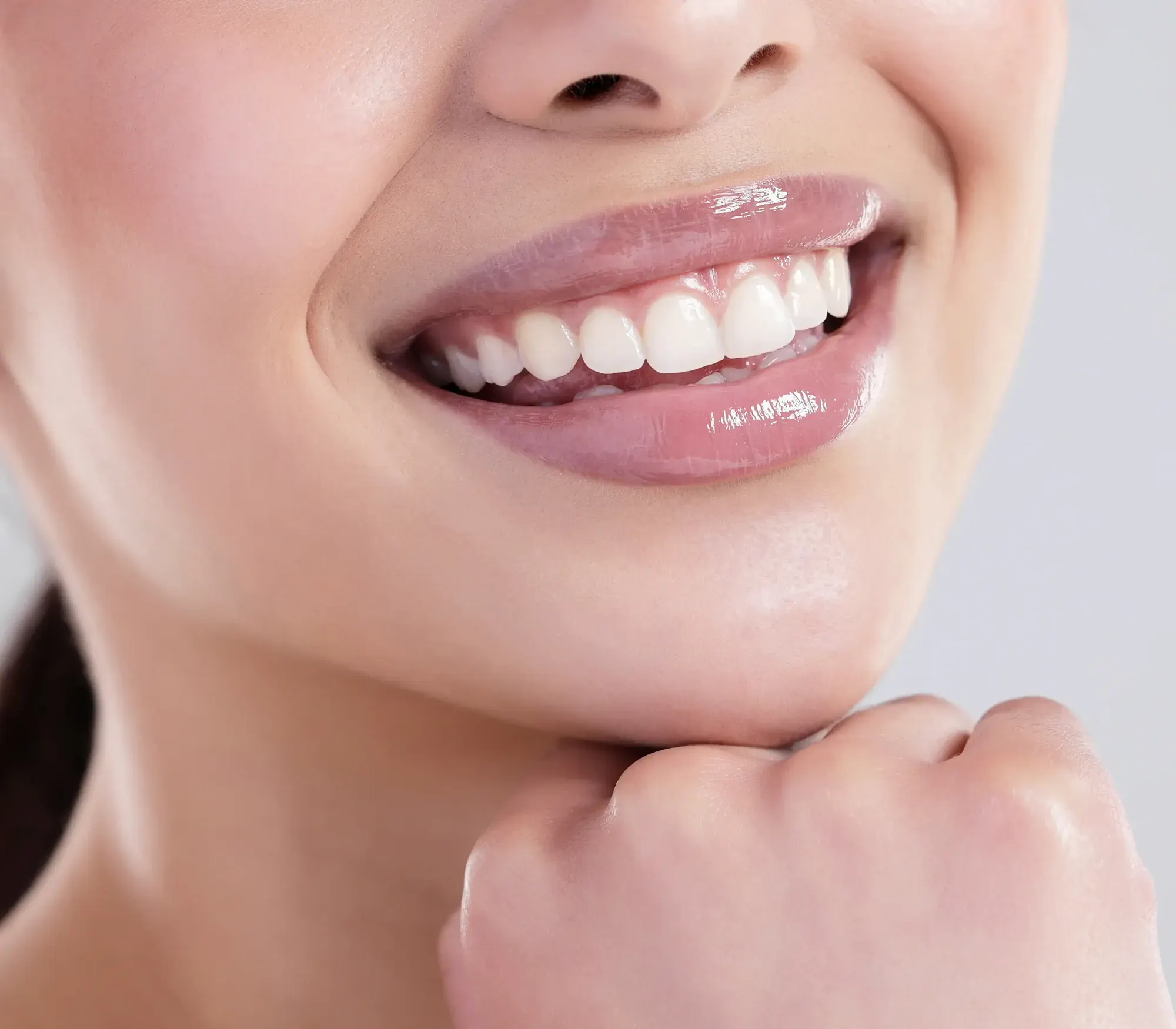 Smiling woman resting her chin on her hand, showing glossy lips and uniform white teeth. Porcelain veneers in NYC