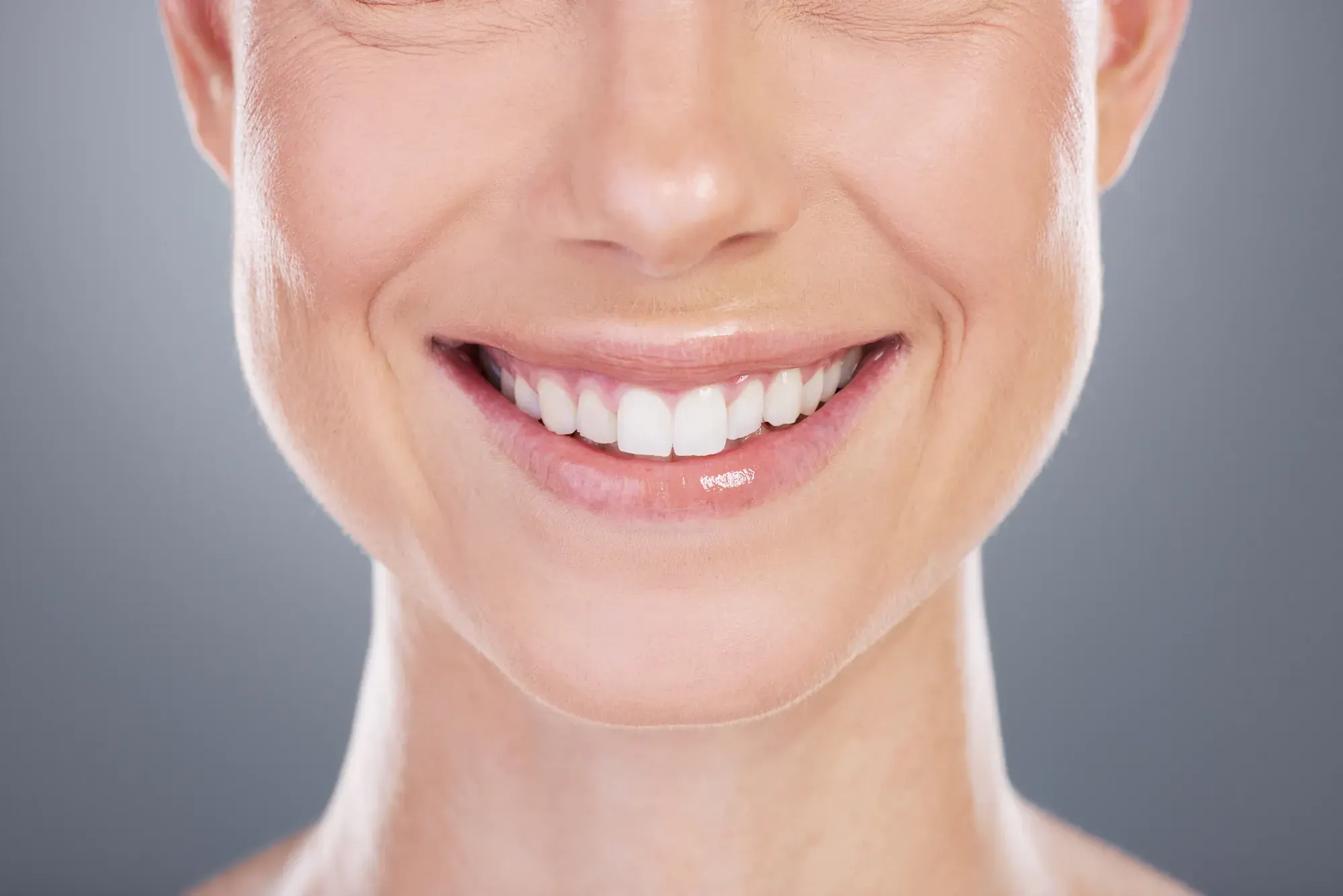 Close-up of a smiling lower face with full lip support and even teeth, showing the focus of the Smile Facelift®